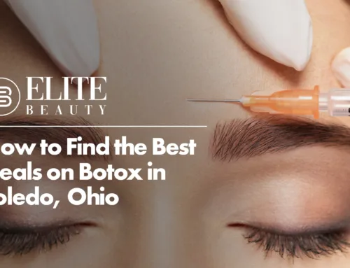 How to Find the Best Deals on Botox in Toledo, Ohio