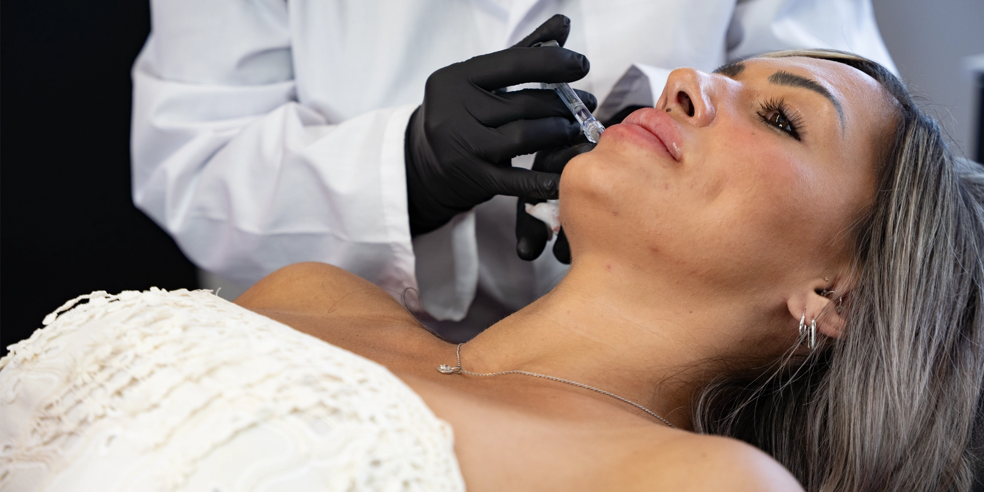 Elite Beauty Lip Filler Toledo Ohio Juvederm Revanesse